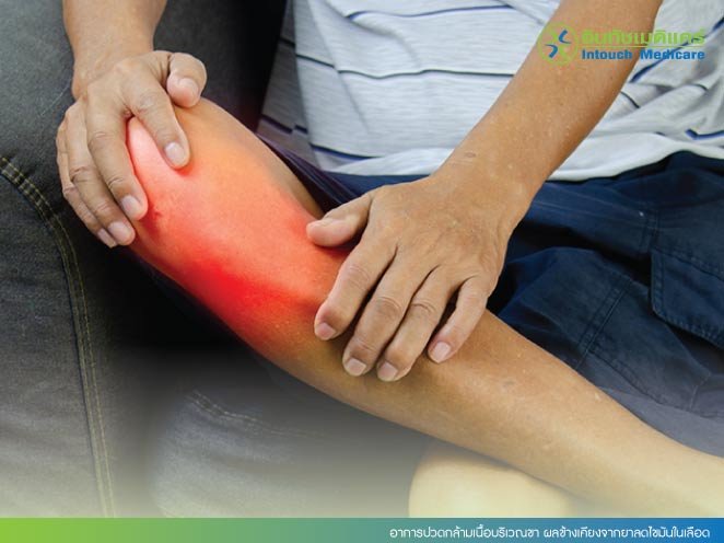 อาการปวดกล้ามเนื้อบริเวณขา ผลข้างเคียงจากยาลดไขมันในเลือด