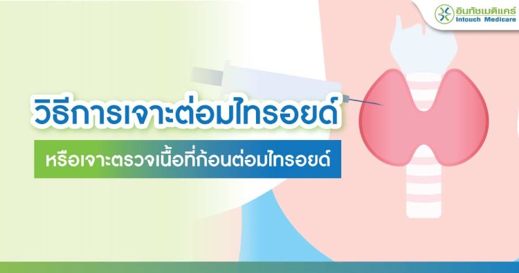 เจาะต่อมไทรอยด์