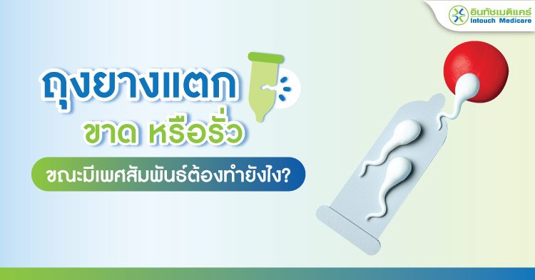 ถุงยางแตก ขาด หรือรั่ว ขณะมีเพศสัมพันธ์ ต้องทำยังไง