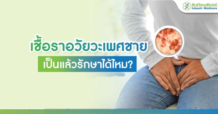 เชื้อราอวัยวะเพศชาย