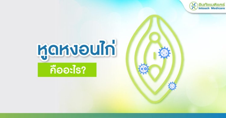 หูดหงอนไก่ คืออะไร