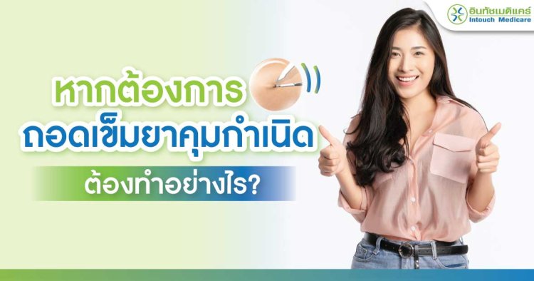 ถอดเข็มยาคุมกำเนิด