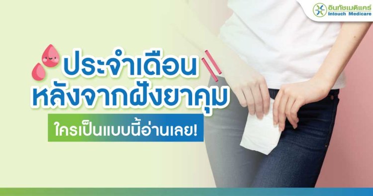 ประจำเดือนหลังจากฝังยาคุม