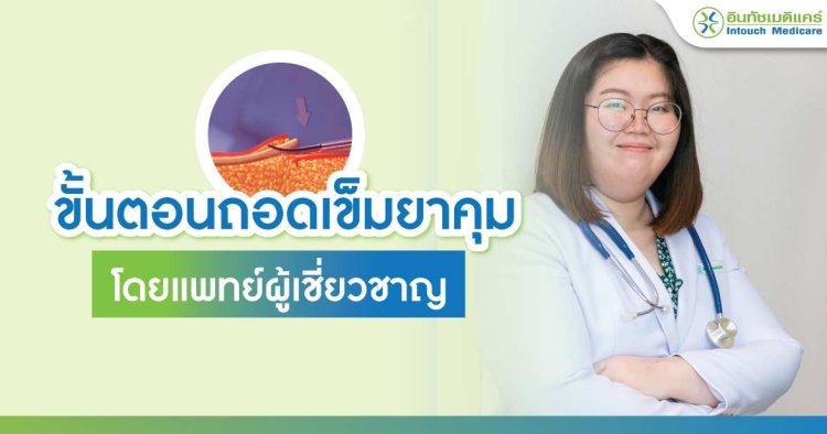 ขั้นตอนถอดเข็มยาคุม โดยแพทย์