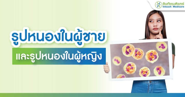 ภาพหนองใน รูปภาพหนองใน