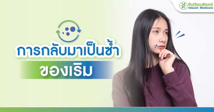 การกลับมาเป็นซ้ำของเริม