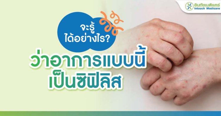 อาการซิฟิลิส