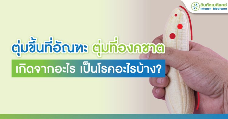 ตุ่มที่อัณฑะ ตุ่มแดงที่อัณฑะ