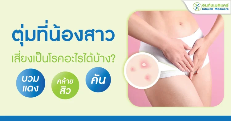 ตุ่มที่น้องสาว เสี่ยงเป็นโรคอะไรได้บ้าง?