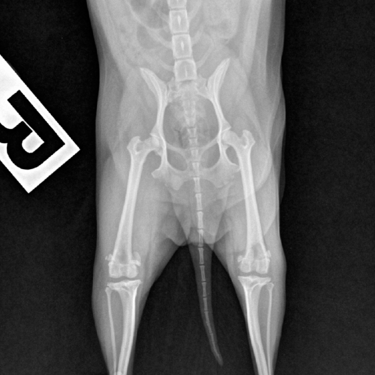เอกซเรย์ (X-Ray)