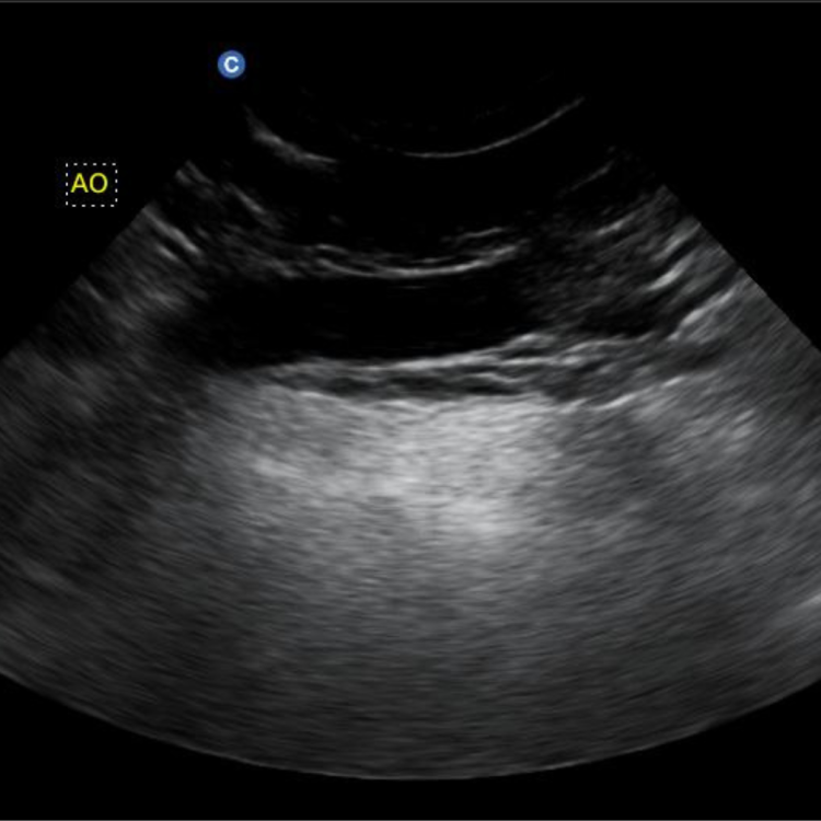 อัลตราซาวด์ อัลตราซาวด์