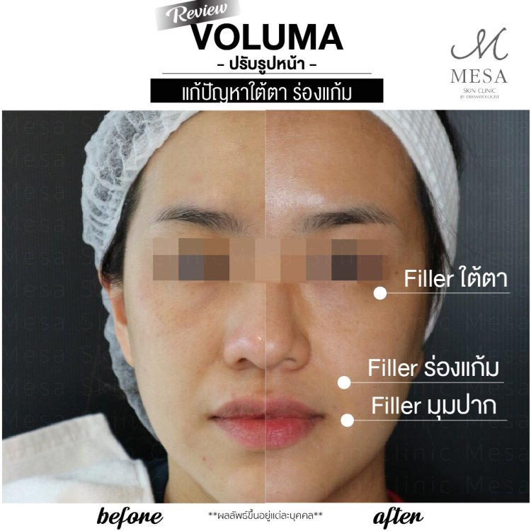 Voluma
