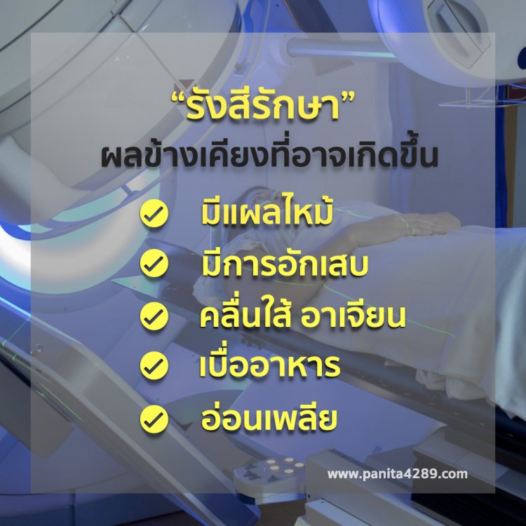 รังสีรักษา
