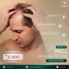 Program MSCs Exosome For Hair