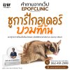 คำถามจากเว็ป Epofclinic คำถามจากเว็ป Epofclinic