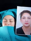 Monika Khurana’s Full Face Lift Journey: Restoring a Firmer and More Defined Facial Contour