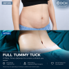Tummy Tuck