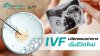 IVF: นวัตกรรมแห่งการเริ่มชีวิตใหม่