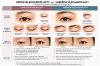 UPPER BLEPHAROPLASTY VS SUBBROW BLEPHAROPLASTY UPPER BLEPHAROPLASTY VS SUBBROW BLEPHAROPLASTY