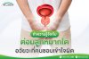 ทำความรู้จัก ต่อมลูกหมากโต