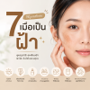 ดูแลฝ้า