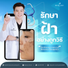 เจาะลึกสาเหตุ ประเภท และวิธีรักษาฝ้า เจาะลึกสาเหตุ ประเภท และวิธีรักษาฝ้า