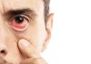 ตาแดง conjunctivitis ทำยังไง เจ็บตา