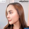 เสริมหน้าผาก เสริมหน้าผาก