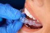 invisalign dt Digital Dental Center