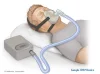 P.K. Healthcare : ทำความรู้จักกับเครื่อง CPAP และการใช้งาน