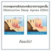 ภาวะหยุดหายใจขณะหลับจากการอุดกลั้น Obstructive Sleep Apnea (OSA) คืออะไร ? ภาวะหยุดหายใจขณะหลับจากการอุดกลั้น Obstructive Sleep Apnea (OSA) คืออะไร ?