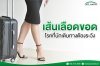 เส้นเลือดขอด เส้นเลือดขอด