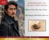Understanding Hair Loss: The Role of DHT Hormone Understanding Hair Loss: The Role of DHT Hormone