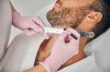 SIDEBURNS Transplant