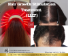Low-Level Laser Therapy (LLLT) Low-Level Laser Therapy (LLLT)