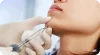 ฉีดฟิลเลอร์ (filler) คืออะไร ก่อนฉีดครั้ง แรก มีความเสี่ยงอะไรบ้าง (mock up)