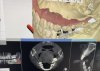 เอ็กซเรย์ 3D (CBCT) มีประโยชน์และสำคัญต่อการทำฟันอย่างไร เอ็กซเรย์ 3D (CBCT) มีประโยชน์และสำคัญต่อการทำฟันอย่างไร