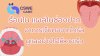 ร้อนใน แผลในช่องปาก และอาการเจ็บคอจากไวรัส เกิดจากอะไร?