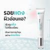 ประโยชน์ EXO-SKIN Repair Cream ช่วยให้รอยแดงแลดูจางลง ผิวดูแข็งแรง ชุ่มชื้นและฉ่ำเงา