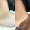 Reviews CO2 Laser