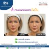 รีวิวเทอร์มาจ