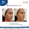 รีวิวเทอร์มาจ