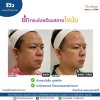 รีวิวเทอร์มาจ