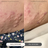 Reviews Scar Clinic