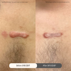 Reviews Scar Clinic