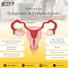 Endometriosis: Unmasking the Painful Truth Endometriosis: Unmasking the Painful Truth