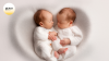 Conceiving Twins Safely through IVF Conceiving Twins Safely through IVF