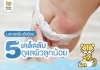 ผื่นผ้าอ้อม ผื่นผ้าอ้อม