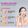 การรักษาหลุมสิวให้หายขาดด้วยการทำ Subcision (ซับซีชั่น)