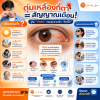 ต้อลม คืออะไร ต้อลม คืออะไร